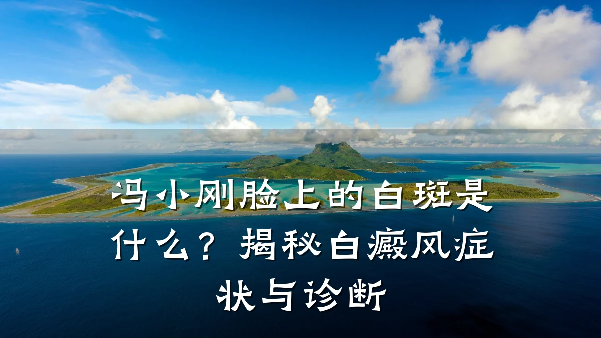 冯小刚脸上的白斑是什么？揭秘白癜风症状与诊断